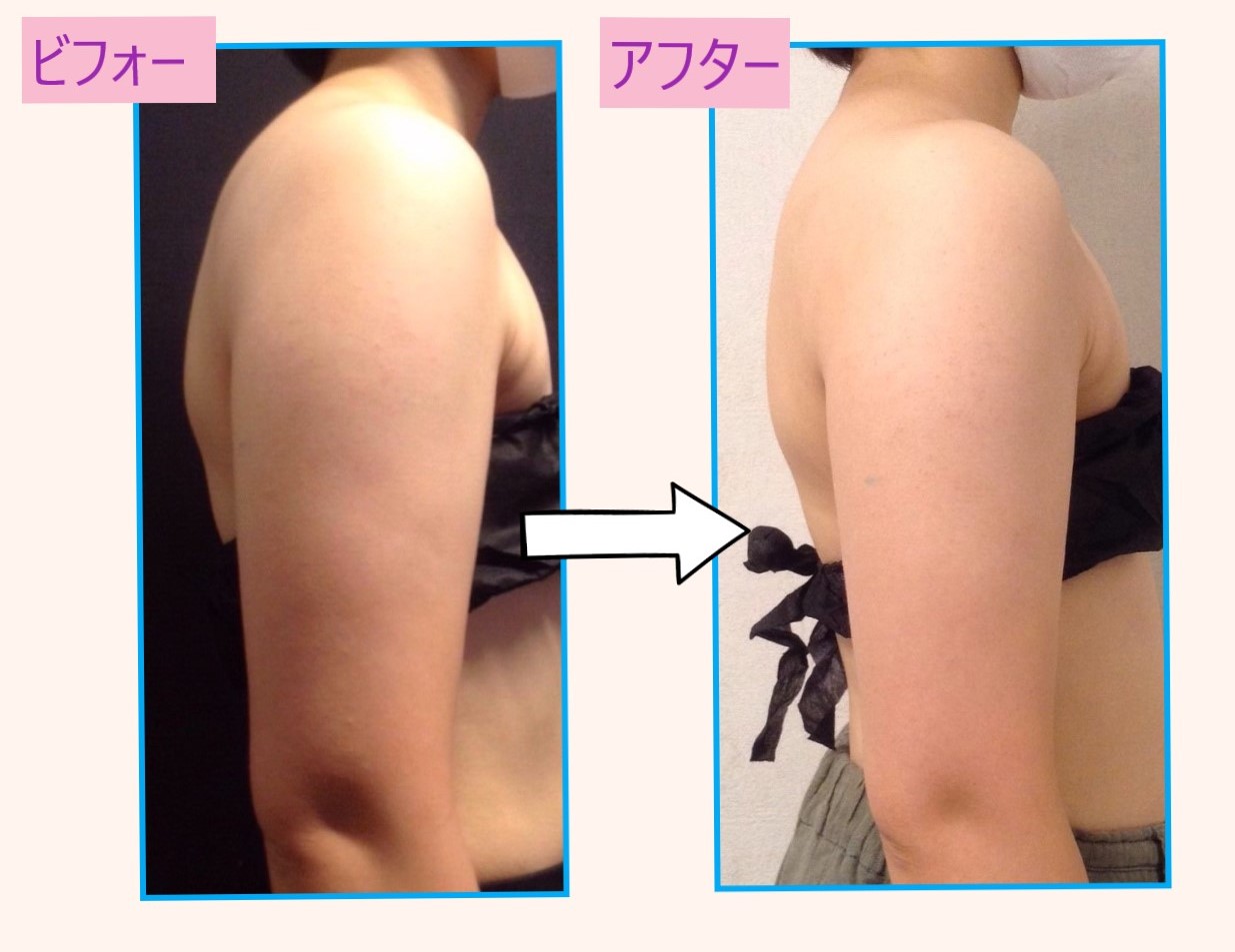 送料込】キャビゼロ cavi ZERO 美容/痩身/キャビテーション 動作