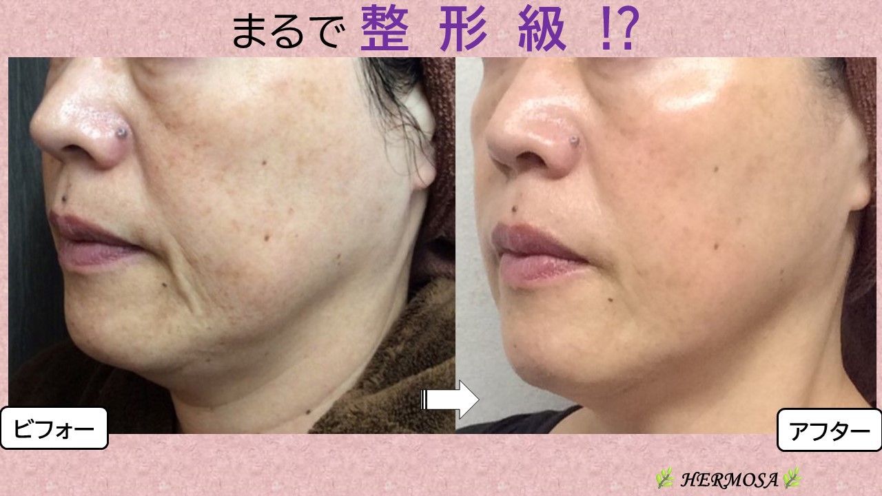 エルモサハーブ、グリーン、ブラック エルモサハーブ＆エルモサ